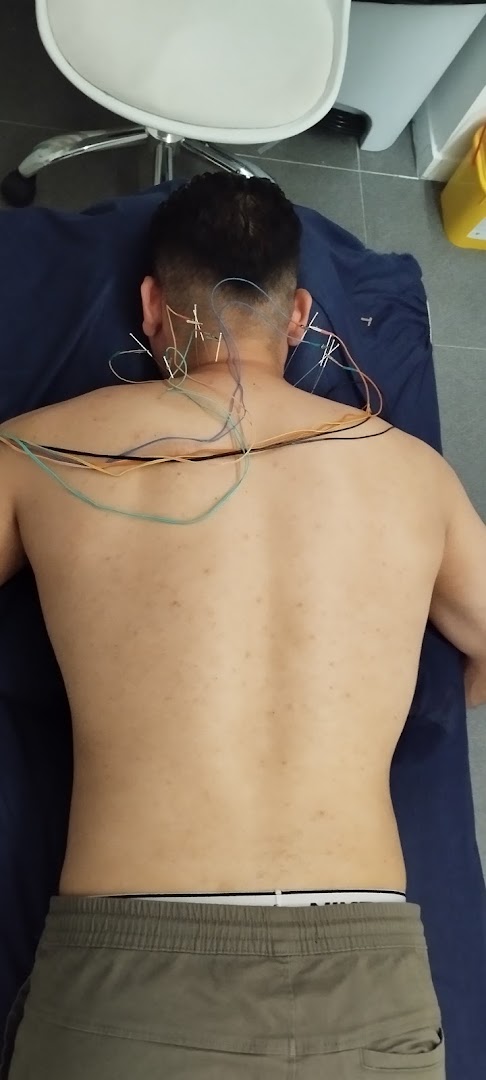 Acupuntura, Osteopatía, Masaje.Salud natural Galicia · Fotos 14